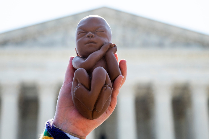 Grupo provida advierte que la prohibición federal del aborto de 15 semanas puede presionar a los estados a "diluir" las restricciones